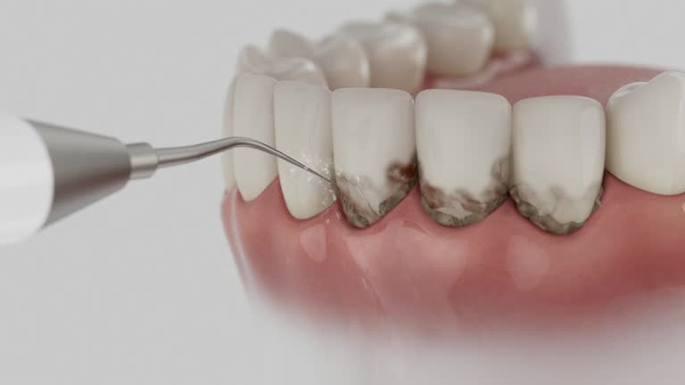 Reliable Teeth Cleaning And Checkup contractor in Genesee County County, MI by Dentist Open Now